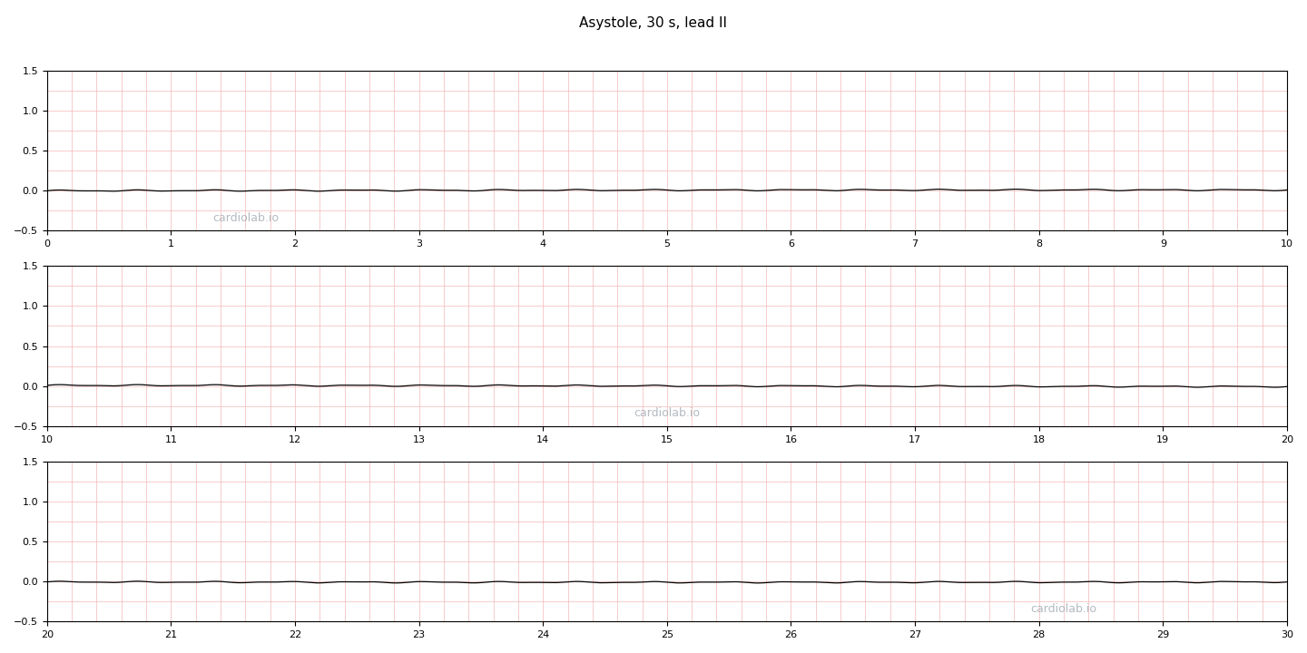 30 seconds of asystole in lead II: a flat line with no P waves, no QRS complexes and no T waves.
