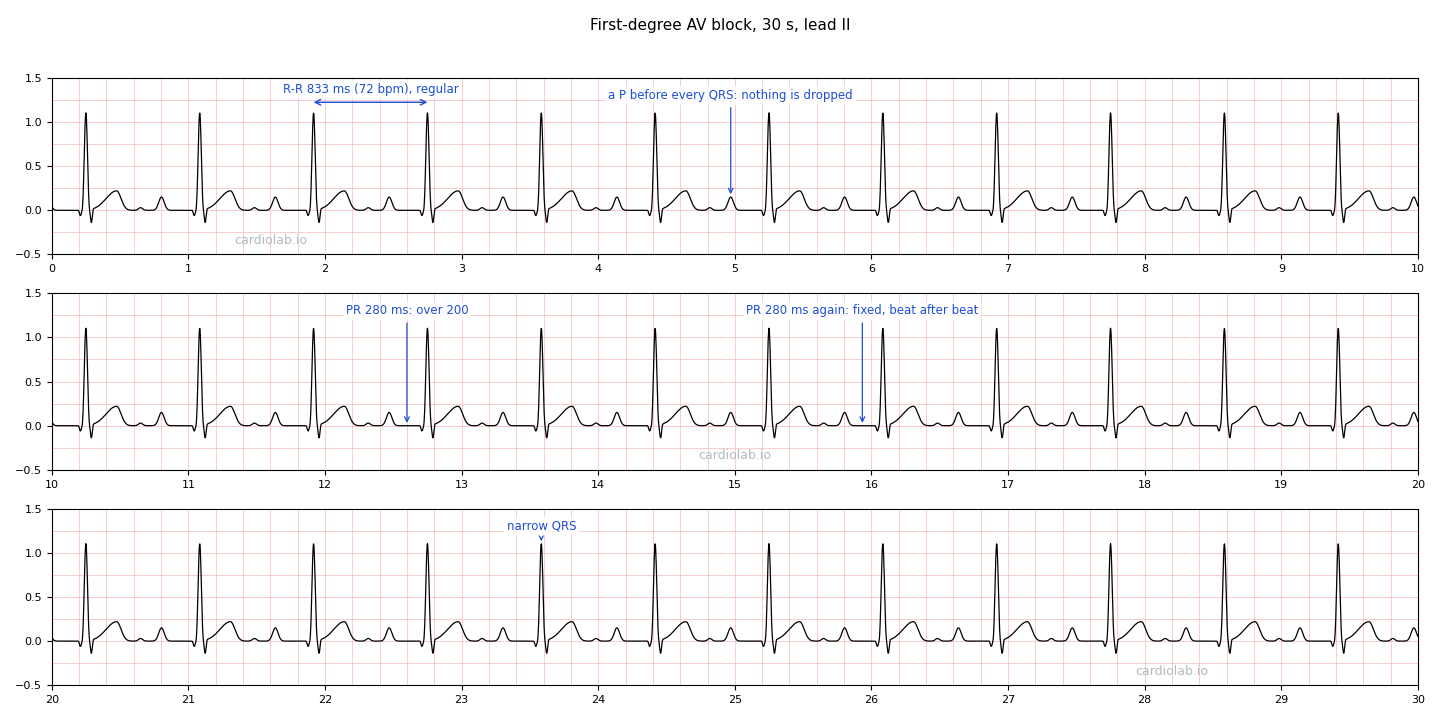 The same first-degree AV block strip, annotated: one R-R interval bracketed at 833 ms (72 bpm), an arrow to a P wave with its QRS, two arrows to the PR interval reading 280 ms on two different beats, and one to a narrow QRS.