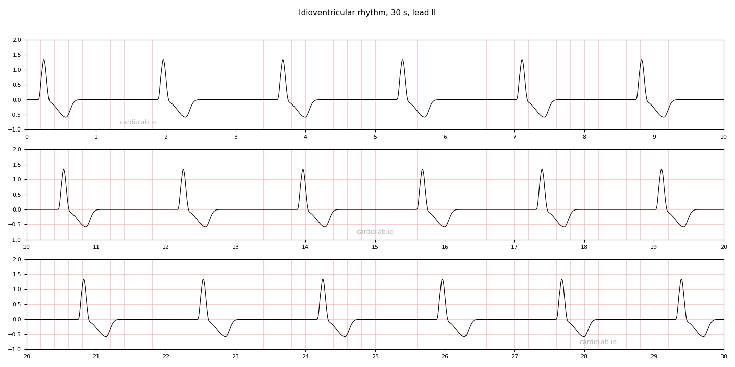 30 seconds of idioventricular rhythm in lead II: a slow, regular rhythm of wide identical complexes at 35 per minute with no P waves.