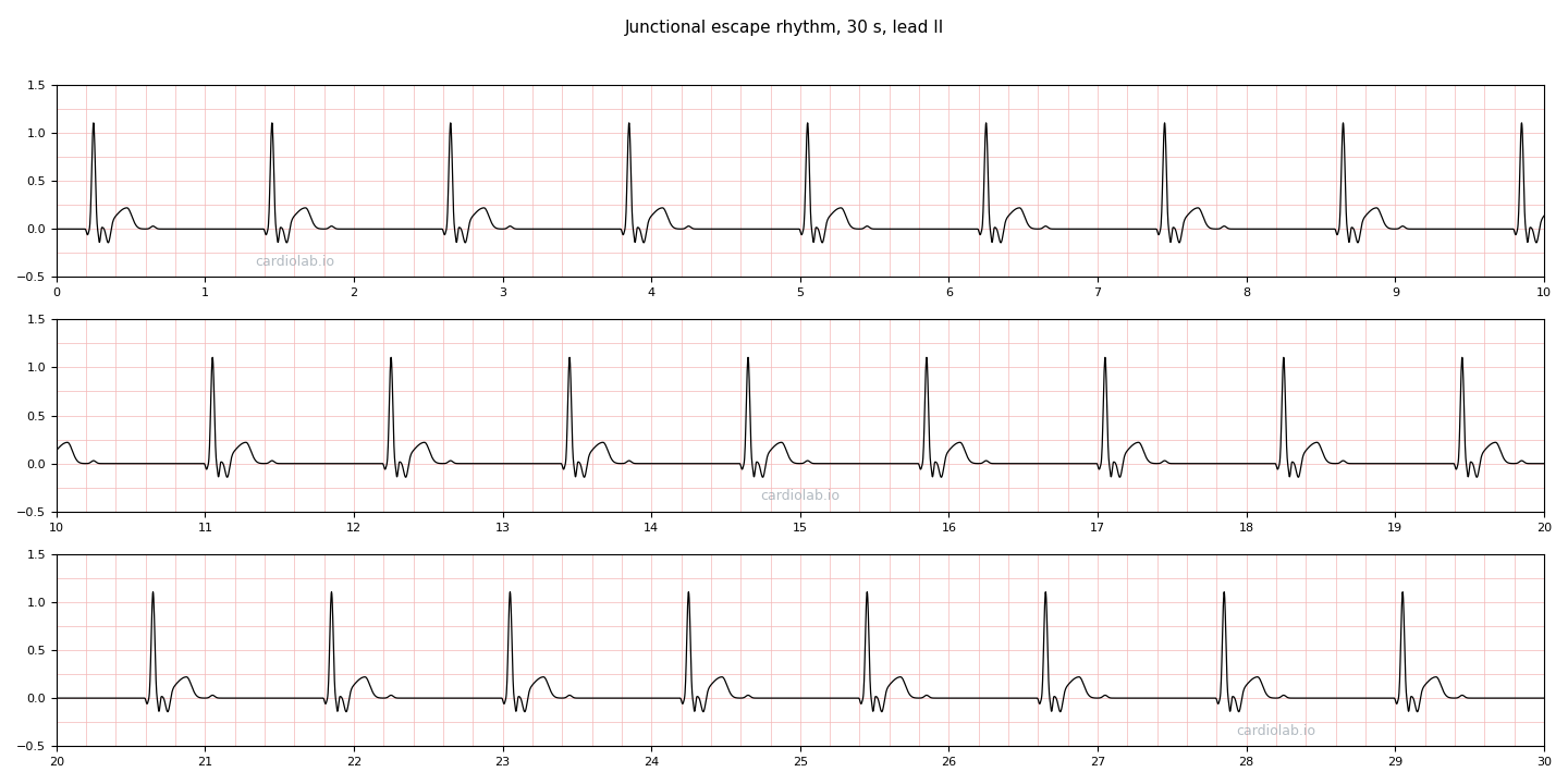 30 seconds of junctional escape rhythm in lead II: a slow, perfectly regular narrow-complex rhythm at 50 per minute with no P wave before any QRS and an inverted retrograde P wave in the ST segment after each one.