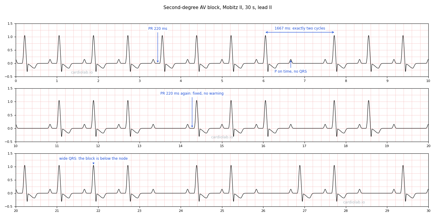 The same Mobitz II strip, annotated: arrows to the PR interval on two beats, both 220 ms, an arrow to a P wave with no QRS after it, a bracket over the pause reading 1667 ms (exactly two cycles), and an arrow to a wide QRS.